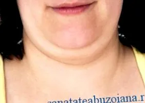 zsírt