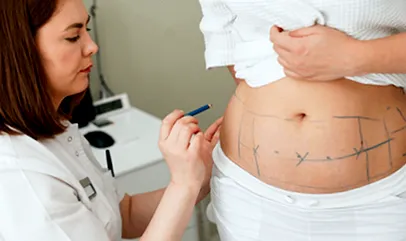 lipo
