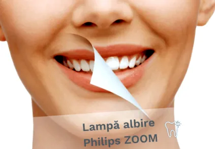 zoom fehérebb
