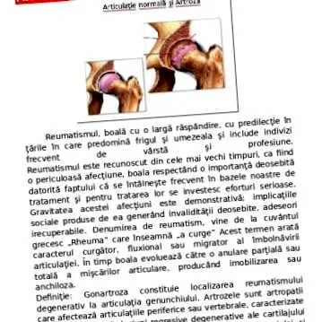 ízületi gyulladás