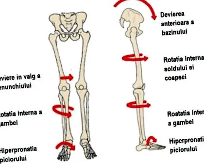 rheumatoid rheumatoid