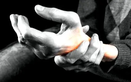 osteoarthritis