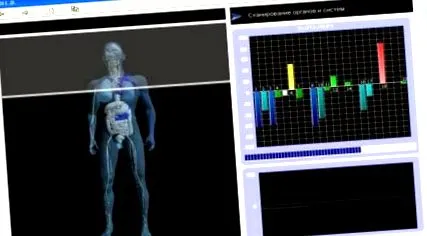 electrosomatograma