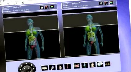 electrosomatograma