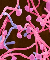 candidiasis