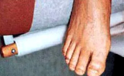arthritis okai