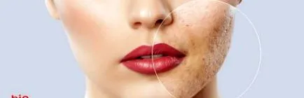 шрами