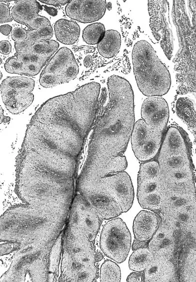 acuminata