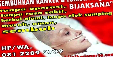 eltávolítani