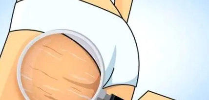 отстранат