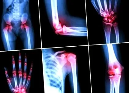 torna torna