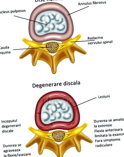 porcszövetének