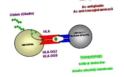 hla-dq2dq8 генетично
