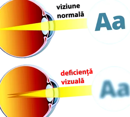 látást