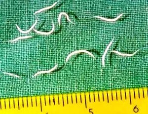 vermicularis