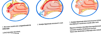CSID történik