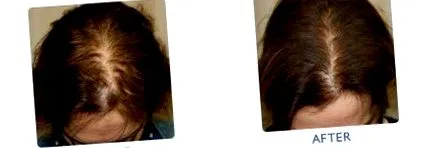 стимуляція