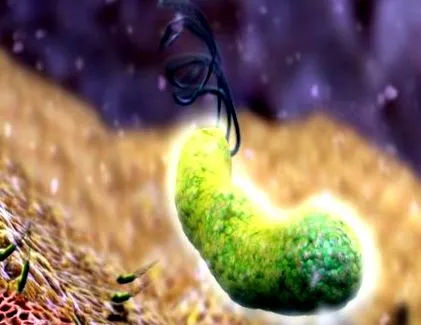 helicobacter