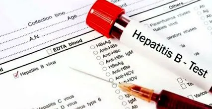 hepatitis vírussal fertőzött