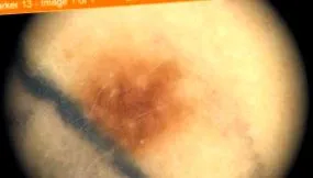 ellenőrizni vakondtérképet
