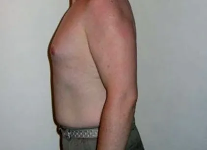 2006
