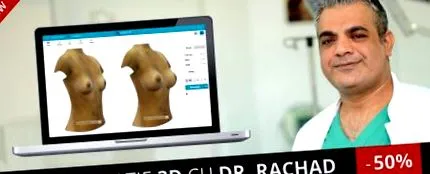ліпосакції