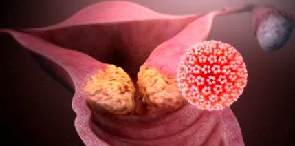 rana