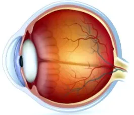 difebioma