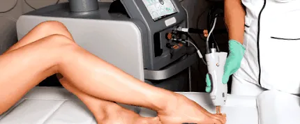 onychomycosis