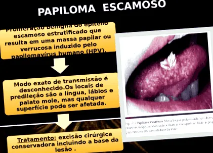 okai típusai
