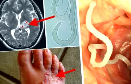 paraziták