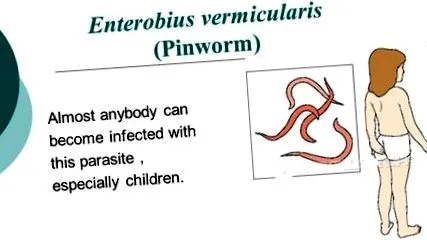 pinworm