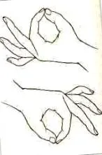 csukló csontjai rheumatoid arthritis