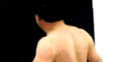 osteoarthritisével