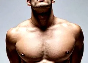 gynecomastia