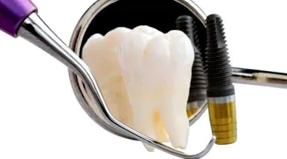 implantátum