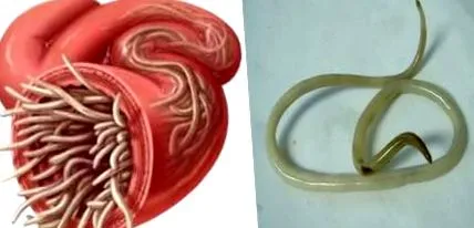 pinworms