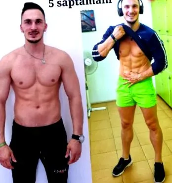 митеа