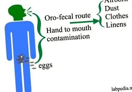 oxyuris