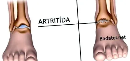 ajuta alimente