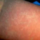 педијатар