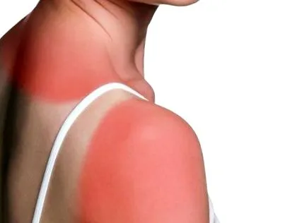 hogyan