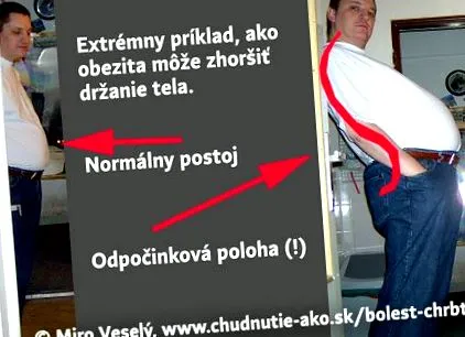 корема