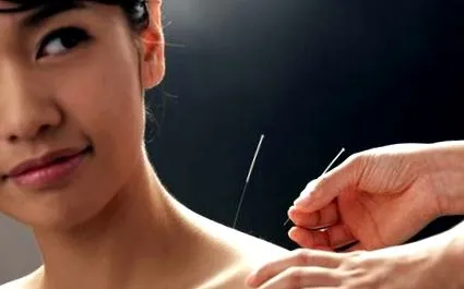 netezirea acupunctura