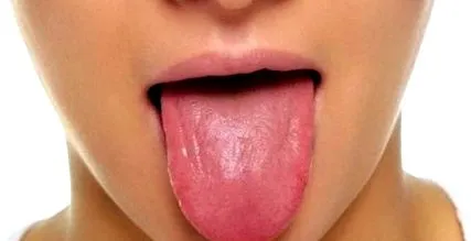 aromate