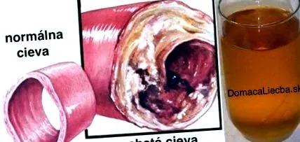 lehet eldugult