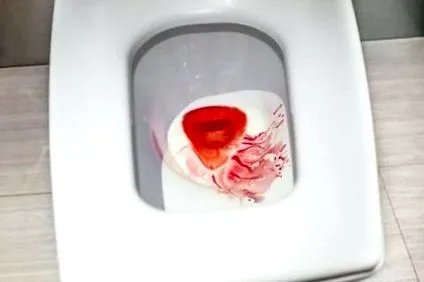 doare stomacul