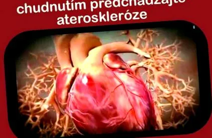отслабване отслабване