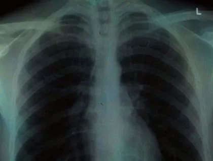 detoxifiere