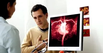 stent stent